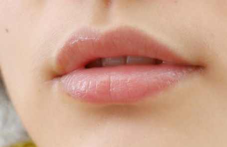 秋季嘴唇起皮，要怎么护理唇部？